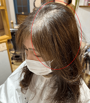 After