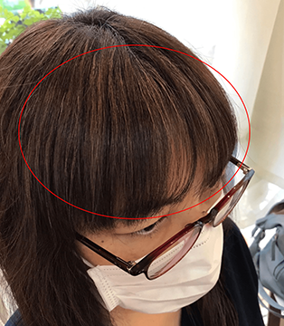 After