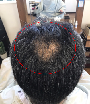Before