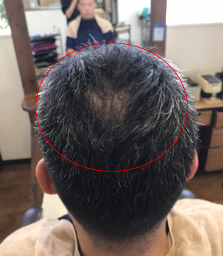 After