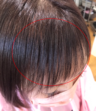 After